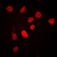 Anti-CstF-64 Antibody