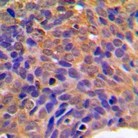 CTNNB1 antibody