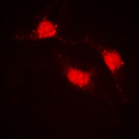 CTNNB1 antibody