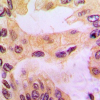 Anti-Cathepsin D Antibody