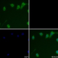 Anti-Cathepsin D Antibody