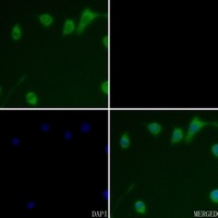 CTSD antibody