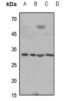 Cathepsin D HC Rabbit Polyclonal Antibody