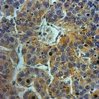Anti-Cathepsin D HC Antibody