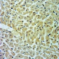 Anti-Cathepsin D LC Antibody