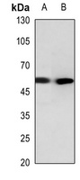 Cathepsin E Antibody