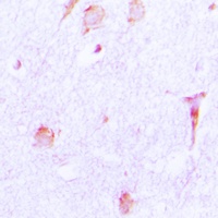 Cathepsin E Antibody