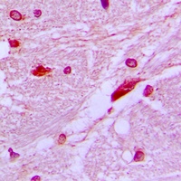 Anti-CUX1 Antibody