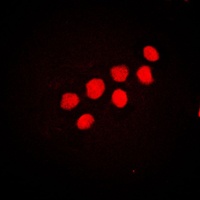 Anti-CUX1 Antibody