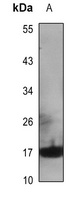 Cytochrome b5A Rabbit Polyclonal Antibody
