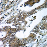 Anti-gp91 phox Antibody