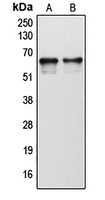 Cytochrome P450 1B1 Rabbit Polyclonal Antibody