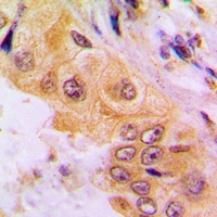 Cytochrome P450 2A7 Antibody
