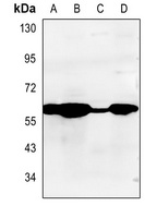 Cytochrome P450 2A13 Rabbit Polyclonal Antibody