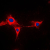 Anti-Cytochrome P450 2A13 Antibody
