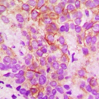 Anti-Cytochrome P450 2B6 Antibody