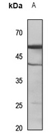 Cytochrome P450 2C9 Antibody