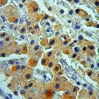 Anti-Cytochrome P450 2D6 Antibody