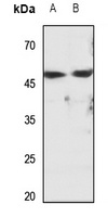 Cytochrome P450 2D6 Antibody