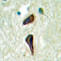 Anti-Cytochrome P450 2E1 Antibody