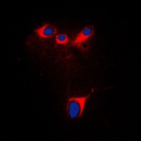Anti-Cytochrome P450 2E1 Antibody