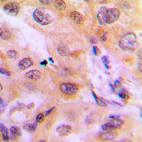 Anti-Cytochrome P450 2J2 Antibody