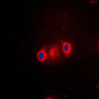 Anti-Cytochrome P450 2J2 Antibody