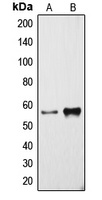 Cytochrome P450 3A4 Rabbit Polyclonal Antibody