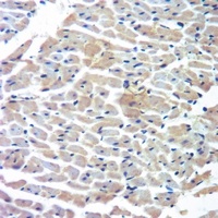 Anti-Cytochrome P450 4A11/22 Antibody