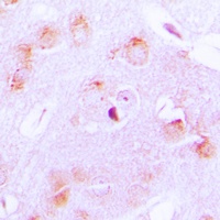 Anti-Cytochrome P450 17A1 Antibody