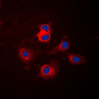 Anti-Cytochrome P450 17A1 Antibody