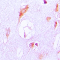 Anti-Cytochrome P450 27A1 Antibody