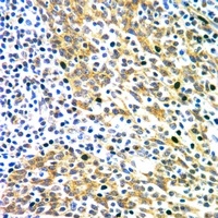 DAB1 antibody