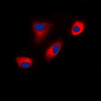 Anti-DAB1 Antibody