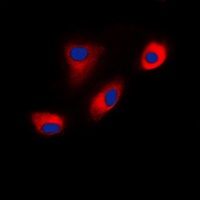 DAB1 antibody