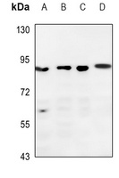 DGK beta Rabbit Polyclonal Antibody