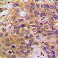 Anti-DAXX Antibody