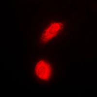 Anti-DAXX Antibody