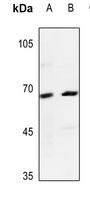 Dopamine beta Hydroxylase Antibody