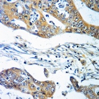 Anti-Dopamine beta Hydroxylase Antibody