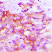 Anti-TRP2 Antibody