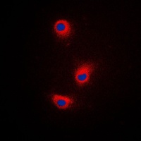 Anti-TRP2 Antibody