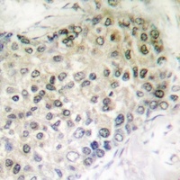 Anti-GADD153 (Phospho-S30) Antibody