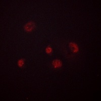 Anti-GADD153 (Phospho-S30) Antibody