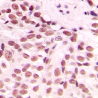 Anti-GADD153 Antibody