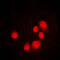 Anti-GADD153 Antibody