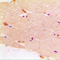 Anti-Desmin Antibody