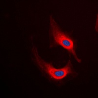 Anti-Desmin Antibody