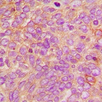 Anti-DFF45 Antibody