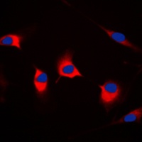 Anti-DFF45 Antibody